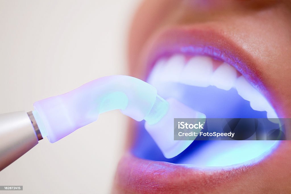 Laser Dentistry
